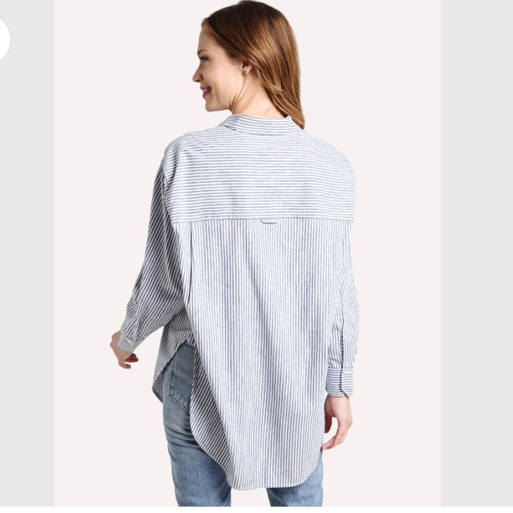 Vince Oversized space dye striped button down Minimalist Coastal Beachy - Picture 8 of 9